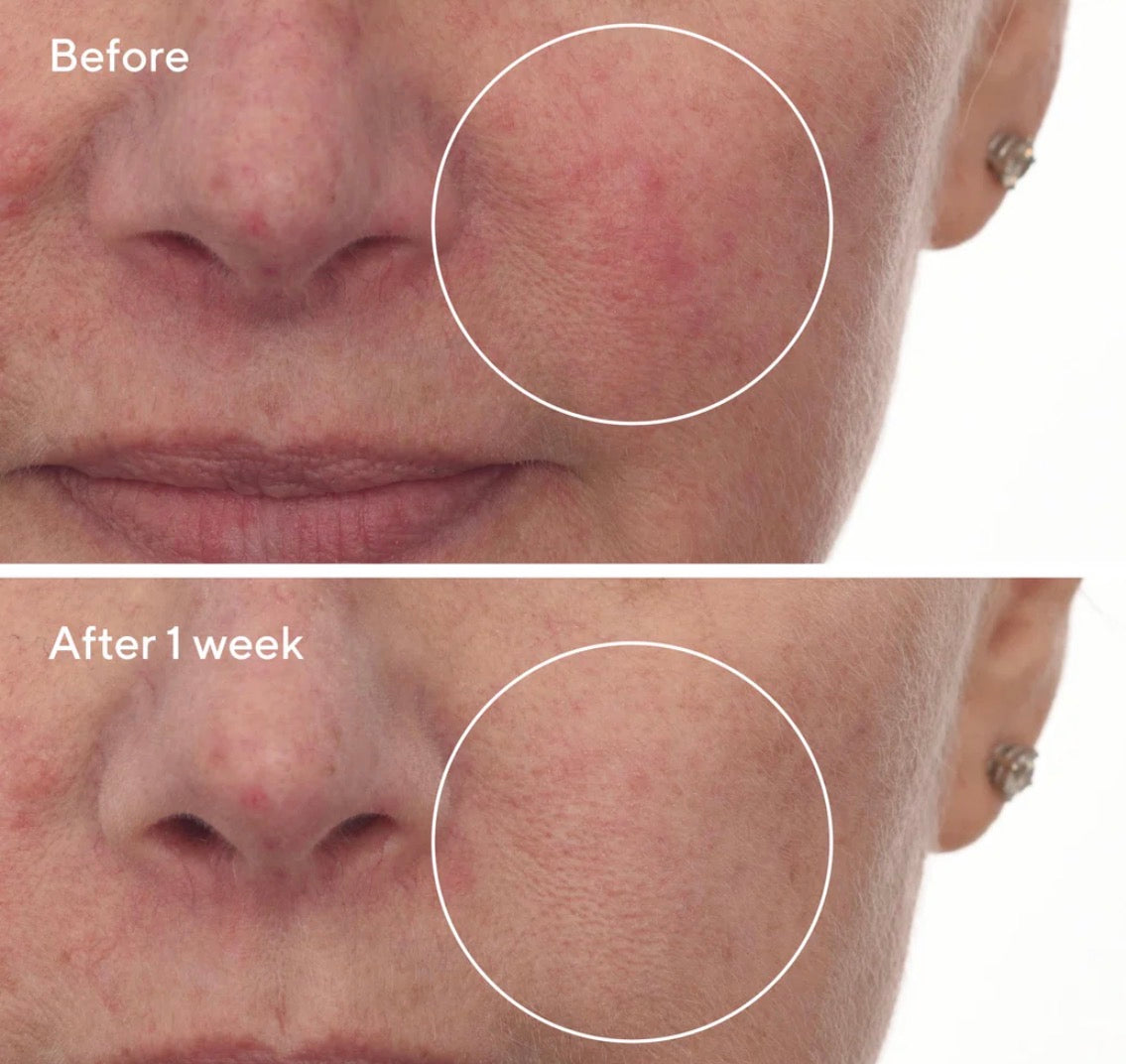 Murad Cellular Hydration Repair Serum 5ml