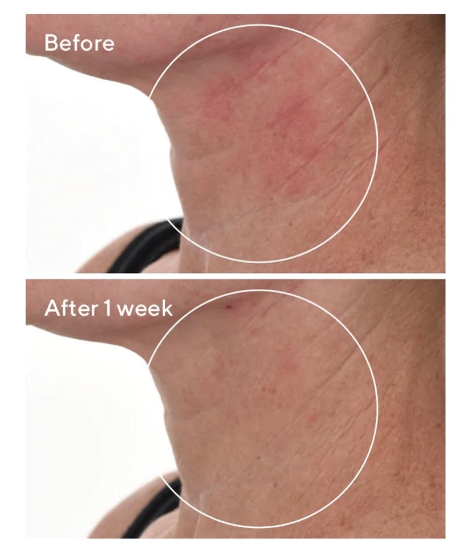 Murad Cellular Hydration Repair Serum 5ml